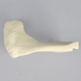 Acromion for ALEX Shoulder Professors