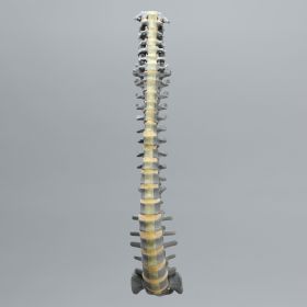 Spine with Ligament Flavum, Full, Radiopaque