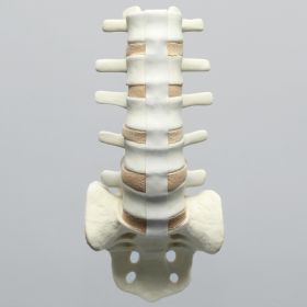 Spine, Lumbar with Laminectomy, Solid Foam