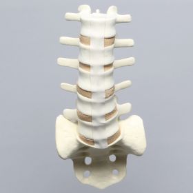 Spine, Lumbar, L1-Sacrum with Tan Discs, Solid Foam