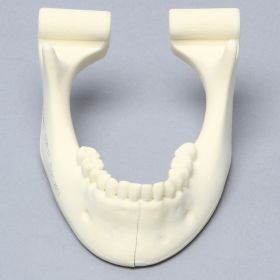 Mandible with Solid Teeth and Sagittal Fracture