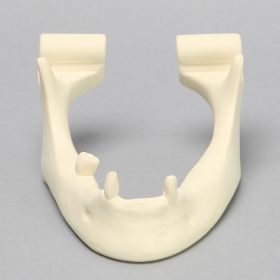 Mandible, Partially Edentulous