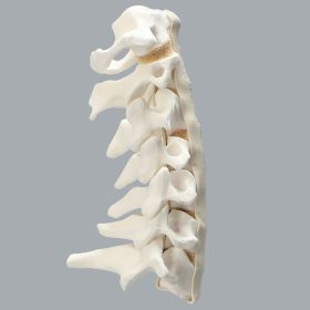 Spine, Cervical, Anterior and Posterior Ligaments, Foam Cortical