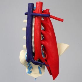 Spine, Lumbar, Left Iliac Crest, with Aorta, Vena Cava, Left Side Psoas, and Nerve Roots, Foam Cortical