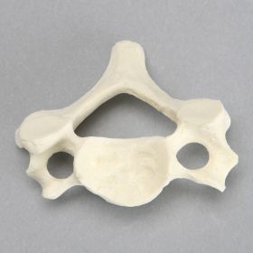 Vertebra, C5, Solid Foam