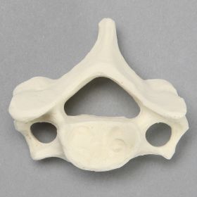 Vertebra, C6, Solid Foam