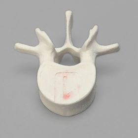 Vertebra, L1, Foam Cortical Shell, For Spinal Navigation