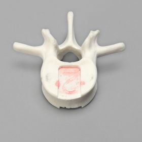 Vertebra, L2, Foam Cortical Shell, For Spinal Navigation