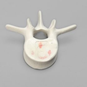 Vertebra, L3, Foam Cortical Shell, For Spinal Navigation