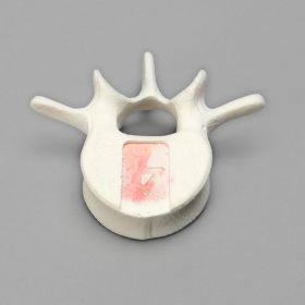 Vertebra, L4, Foam Cortical Shell, For Spinal Navigation