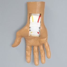 Carpal Tunnel Arthroscopy Wrist Trainer