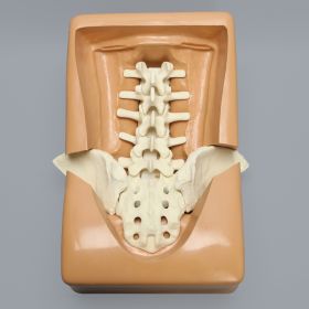 Lumbar Holder with Iliac Wing Cutouts