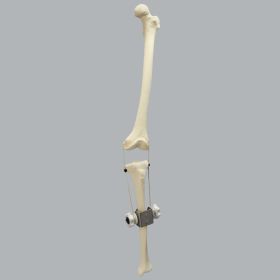 Knee Joint with Adjustable Collateral Ligaments