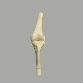 Converge™ Knee Joints