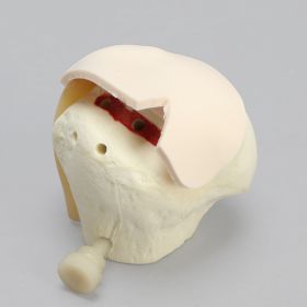 MagneFAST Humeral Head Insert