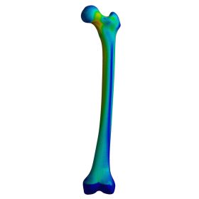 Femur, Finite Element Model of #3406