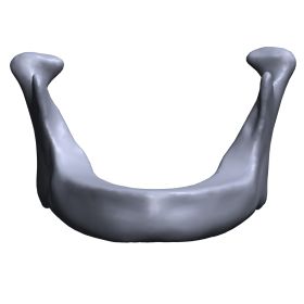 Mandible with Plateau Deformity, Scan of #1336