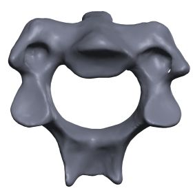 Cervical Vertebra C2, Scan of #1377-40-2