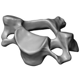 Cervical Vertebra C5, Scan of #1377-40-5