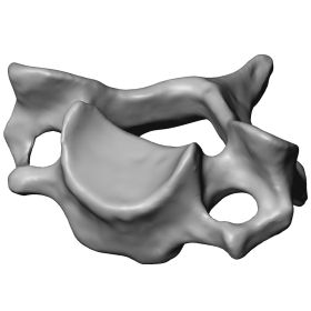 Cervical Vertebra C6, Scan of #1377-40-6