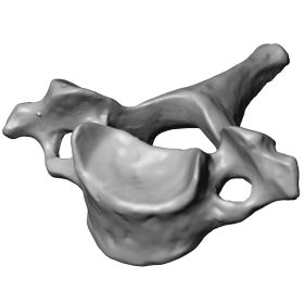 Cervical Vertebra C7, Scan of #1377-40-7