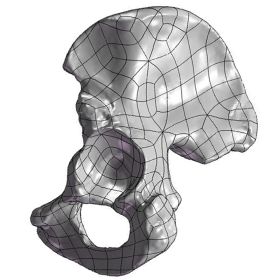 Hemi Pelvis, Scan of #1294