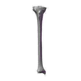 Distal Tibia, Scan of #1126-100