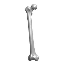 Distal Femur, Scan of #1130-100