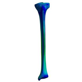 Tibia, Finite Element Model of #3401