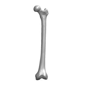 Femur with Condylar Notch, Scan of #1100