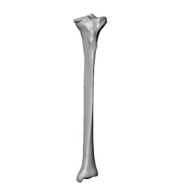 Tibia with Osteoarthritic Pathology, Scan of #1117-4