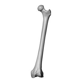 Femur with Osteoarthritic Pathology, Scan of #1121-4