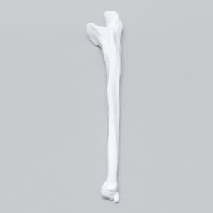 Ulna, 5mm Canal, Plastic Cortical