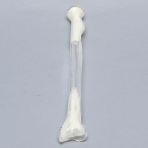 Radius, 5.5mm Canal, Transparent Cortical