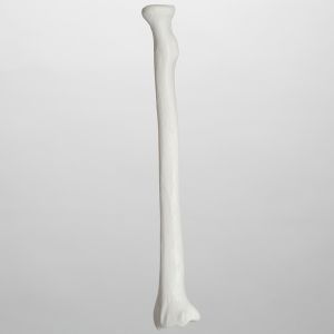 Radius, 5mm Canal, Plastic Cortical Shell