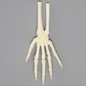 Hand and Wrist, Pediatric , Solid Foam