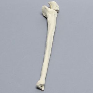 Ulna with Olecranon Fracture, Solid Foam