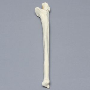 Ulna with Olecranon Fracture, Foam Cortical