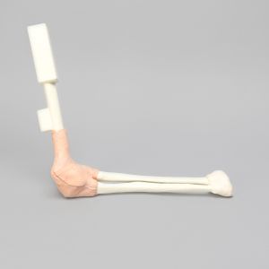 Arthroscopy Elbow Insert with Capsule and Cartilage