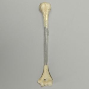 Humerus, Transparent Cortical, Pediatric