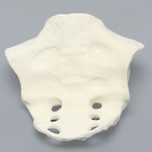 Sacrum, Female, Solid Foam