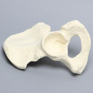 Hemi Pelvis with Osteoarthritis, Solid Foam, Left