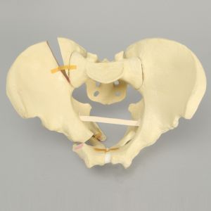 Pelvis with Rami and SI Fractures with Dislocation, Full Male, Foam Cortical