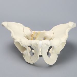 Pelvis  with Sacral and Rami Fractures with Displacement, Full Male,  Foam Cortical