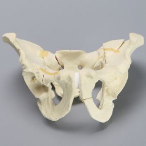 Pelvis with Fractures, Full Male, Foam Cortical