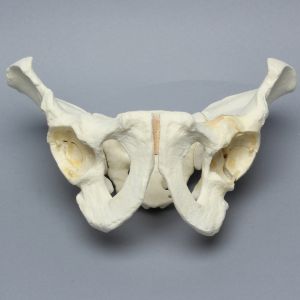 Pelvis with Wall Fractures and Periosteum, Full Male, Foam Cortical