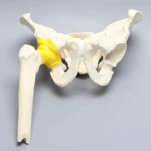 Pelvis with Acetabular Fractures and Femur, Full Male, Foam Cortical