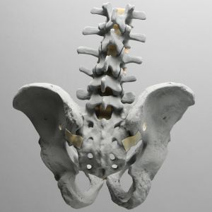 Lumbar Spine with Pelvis, Full Male, Radiopaque