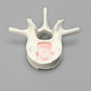 Vertebra, L2, Foam Cortical Shell, For Spinal Navigation