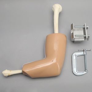 Arthroscopy Elbow